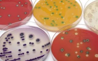 Основные принципы и методы культивирования бактерий
